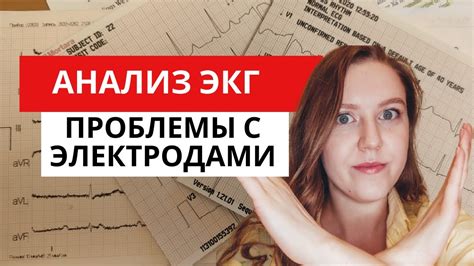 Анализ ЭКГ: что ищет врач?