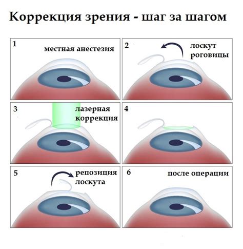 Анализ зрения и коррекция