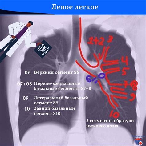 Глава 3: Основные симптомы пленки на легких