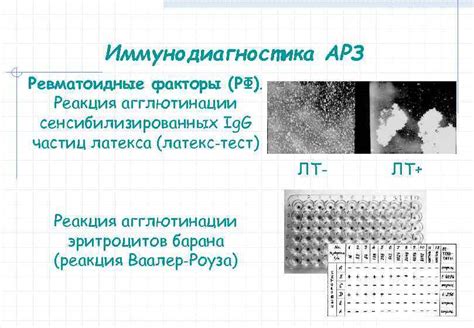 Иммунодиагностика: способы определения статуса