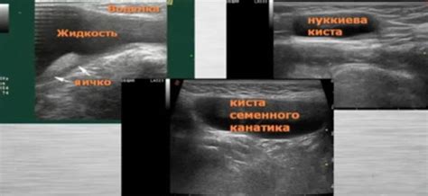 Инновационные методы при лечении грыжи у детей