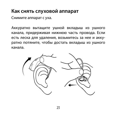 Инструкция по проведению депиляции аппаратом