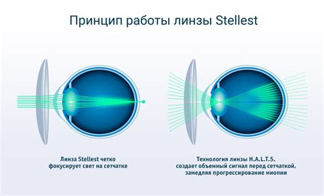 История и принцип работы линзы