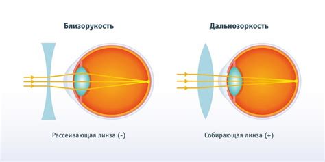 Как изменение диоптрий влияет на зрение