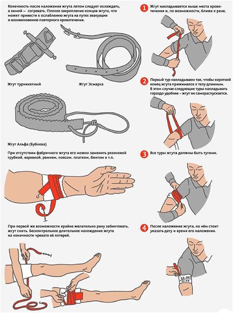 Как использовать жгут эсмарха правильно?
