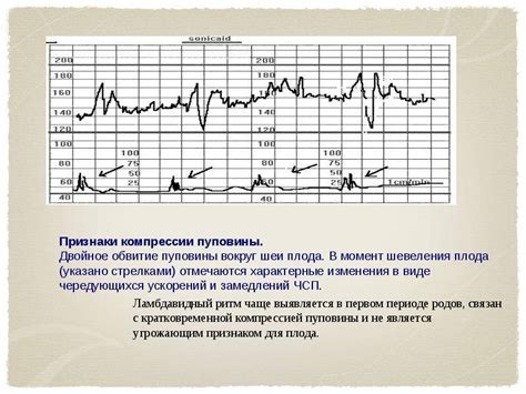 Как определить, являются ли схватки продуктивными