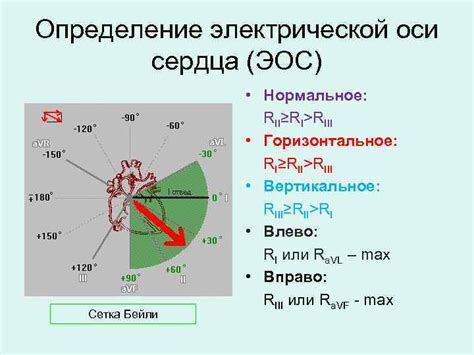 Как определить ЭОС по ЭКГ линейке