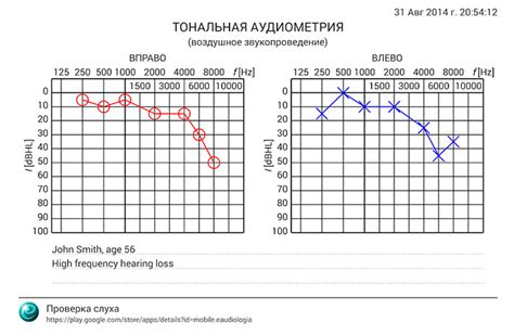 Как определить нарушения слуховой функции по аудиограмме?