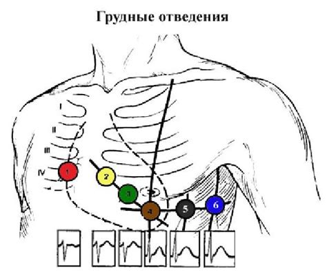 Как провести ЭКГ-исследование правильно