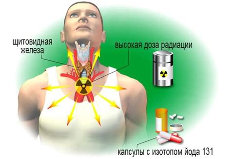 Как провести тест йодом на нехватку щитовидной железы?