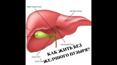 Как работает организм без желчного пузыря