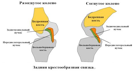 Консервативное лечение порванной связки плеча