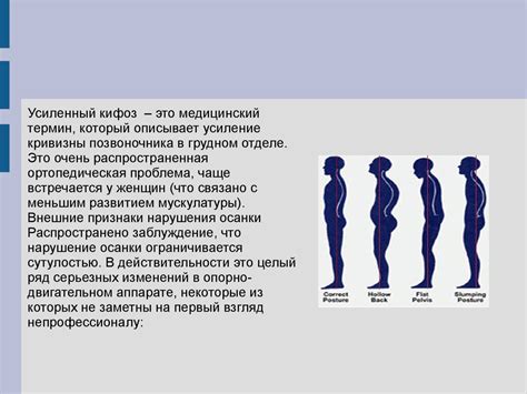 Коррекция осанки