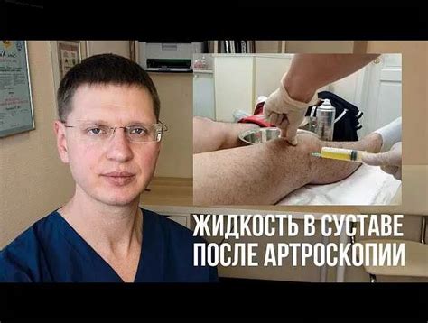 Лечение и профилактика скопления жидкости в колене