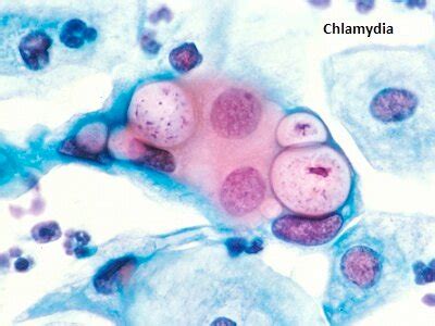 Методы диагностики хламидийной инфекции
