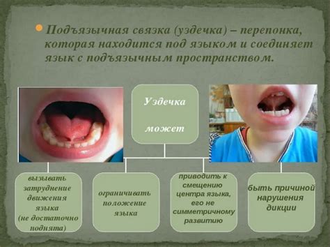 Методы определения уздечки у ребенка