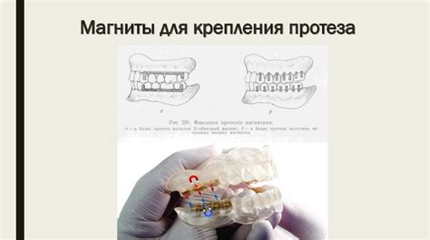 Методы фиксации: выбираем наиболее эффективный способ