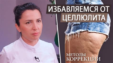 Мифы о борьбе с целлюлитом на ногах