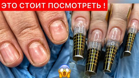 Нанесение акригеля на нижние формы