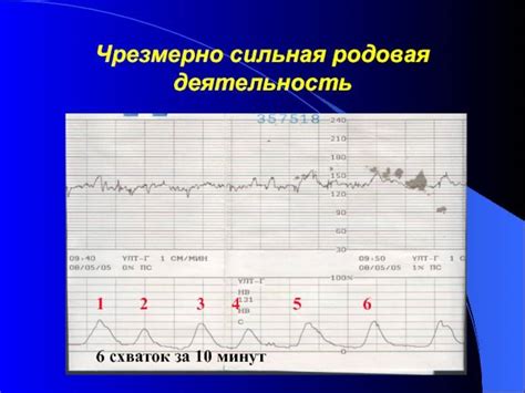 Настройка КТГ-аппарата на основе инструкции