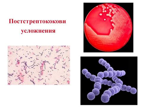 Натуральные методы лечения стрептококка