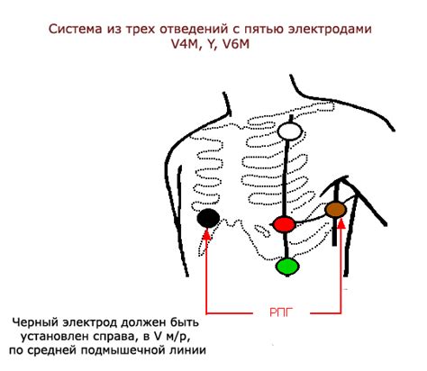 Начало работы миокарда холтера