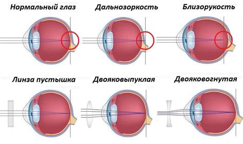 Определение диоптрий в очках