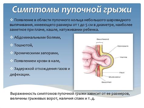 Определение и причины пупочной грыжи