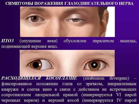 Определение точек интереса и отслеживание движения глазных яблок