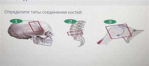 Определите свою плотность костей с помощью специальных тестов