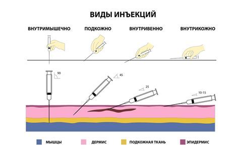 Оптимальная частота уколов вены