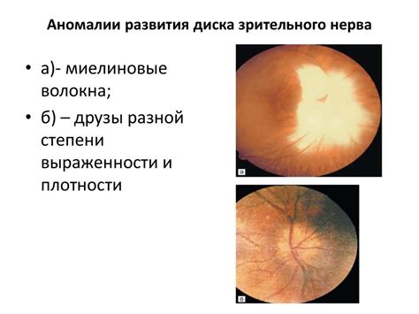 Основные методы диагностики зрительного нерва