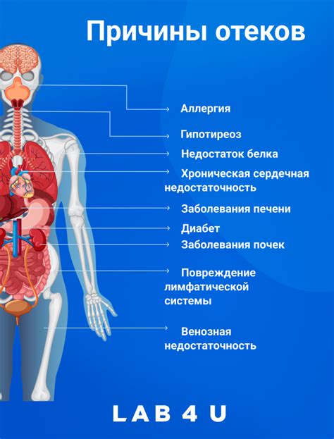 Основные причины отечности