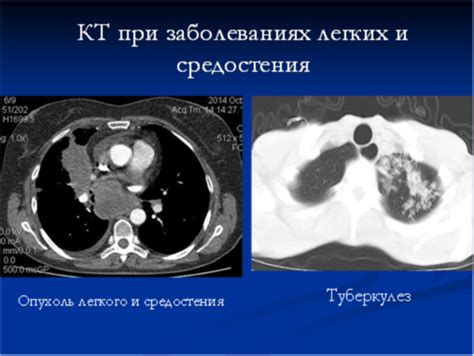 Основные техники покраски женской грудной клетки: нюансы и подходы