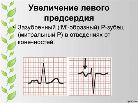 Основы ритма пупа