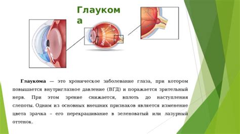 Отображение основных деталей зрачка