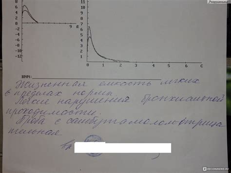 Подготовка ингредиентов для ФВД с бронхолитиком