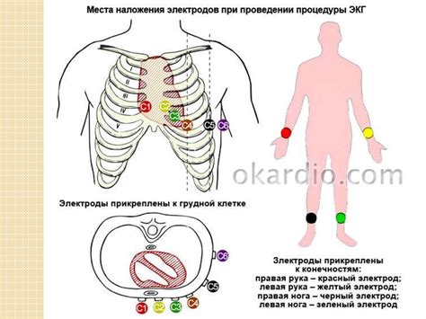 Подготовка к ЭКГ