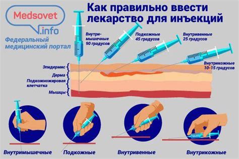 Подготовка к процедуре инъекции