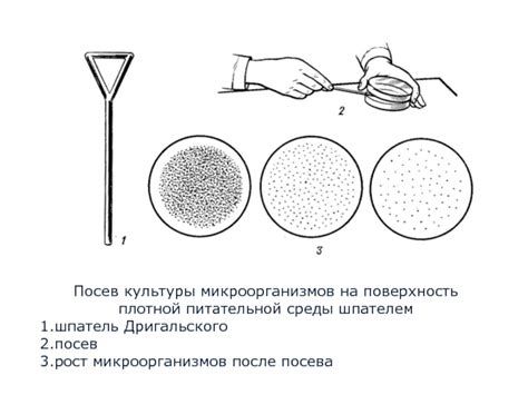 Подготовка посева бактерий