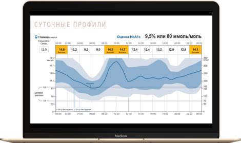 Подключение Найтскаут к Либре