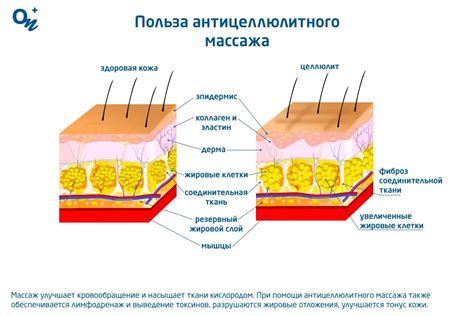 Польза и преимущества антицеллюлитного массажа