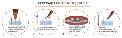 Помещение донорского алмаза