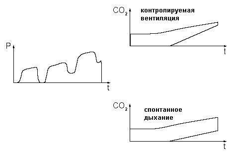 Постепенное повышение уровня сложности