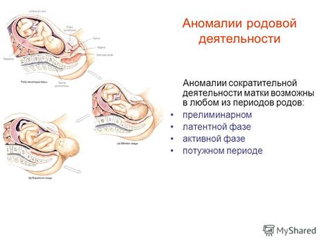 Поступление признаков преждевременных родов