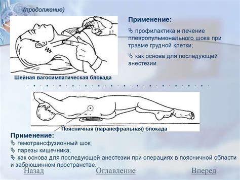 Превосходство местной анестезии перед общей