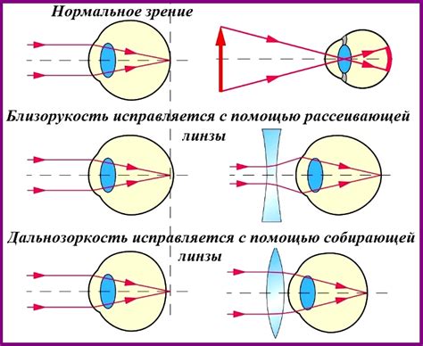 Преимущества правильной проверки и исправления глаз