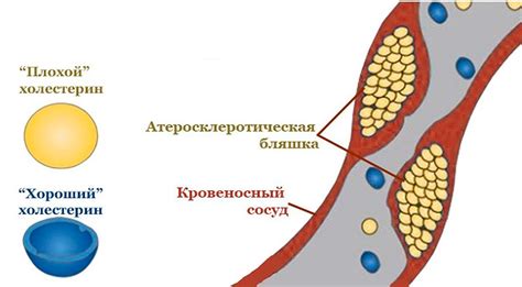 Признаки высокой плотности крови