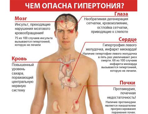 Признаки и симптомы гипертонии 1 степени