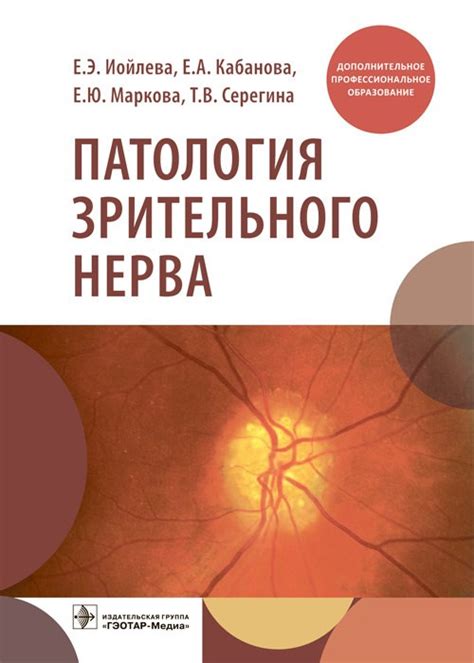 Признаки патологии зрительного нерва и необходимость своевременной диагностики